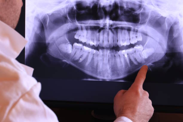 Best Emergency Dental Extractions in Seminole, TX