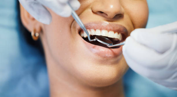 Best Emergency Dentist for Lost Fillings or Crowns in Seminole, TX